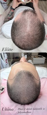 F51BD485-CB80-4252-A8BA-F8349C8BD022